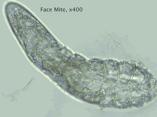 显微镜检测螨虫